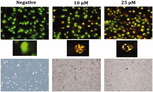 Figure 5. Morphological changes observed under florescence and light microscope in A1 treated HeLa cells after staining with AO/EB. All data are expressed as mean ± SD values from three independent experiments. p-values of less than *p < .05, (compared with the control group) are considered significant.