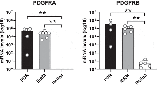 Figure 4. Expression of PDGFRA and PDGFRB in vitreoretinal membranes and human retina. Levels of PDGFRA and PDGFRB mRNA was determined by real-time quantitative PCR and presented as absolute amounts in Log10 scale. Mean ± SD are given of fibrovascular membranes of patients with PDR (PDR, n = 4), idiopathic epiretinal membranes of non-diabetic patients with a macular pucker (iERM, n = 5) and non-diabetic retina (Retina, n = 6). All data points of PDGFRA and one data point of PDGFRB in retina was below 1 and therefore not visible in the graph. The Mann–Whitney U test was used to compare statistical differences between groups (**P < .01)