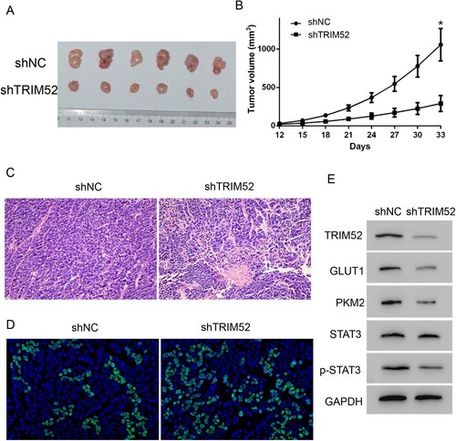 Figure 3. TRIM52 knockdown inhibits tumor growth in vivo. (A) Images of the CAOV3-derived xenograft tumors at the end of study. (B) Tumor growth curves of the CAOV3-derived mouse xenografts. (C) Representative images of H&E staining of the CAOV3-derived tumor sections (magnification ×200). (D) Representative images of TUNEL staining of the tumor sections (magnification ×200). (E) Western blot was used to quantify the protein levels of TRIM52, GLUT1, PKM2, p-STAT3, and STAT3. *P < 0.05 vs. shNC.