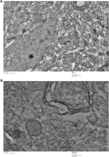 Figure 15 Transmission electron microscopy (TEM) images of brain tissue of Wistar rats injected with a high dose of IONPs (30 mg/kg) and control. Control group shows intact cellular organelles (A), 30 mg/kg treated group’s image showing disintegrated cellular organelles (B).