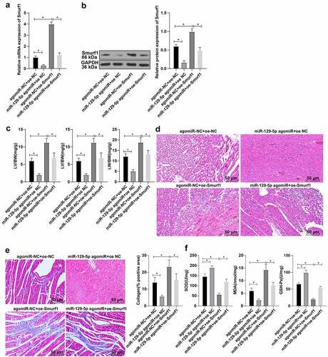 Figure 4. miR-129-5p affected cardiac function in CHF rats through Smurf1. A-B: The levels of Smurf1 in myocardial tissue of rats detected by qRT-PCR and WB; C: The ratios of heart weight/body weight, left ventricle weight/body weight, and lung weight/body weight were measured; D: Histopathological changes of the myocardium observed by HE staining; E: Masson staining observed the degree of myocardial tissue fibrosis; F: The levels of SOD, GSH-Px and MDA detected by ELISA; N = 10; Values in the figure were measurement data and displayed as mean ± standard deviation. Unpaired t test was used for pairwise comparisons; one-way ANOVA was used for comparisons among multiple groups, followed by Tukey’s test. * P < 0.05.