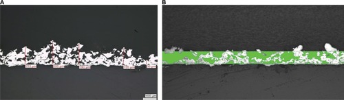 Figure 1 Exemplary sections through Ti-PEEK surface coating.