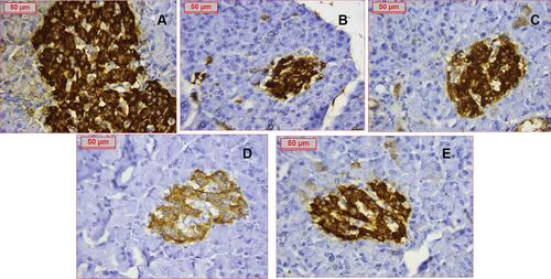 Figure 10 Immunostaining of insulin referring to ß-cells of all groups (A) Control group with assessed ß cells count 160 (B) PCOS group showing dramatic decrease of ß-cells number to around 85 (C) Clomiphene treatment with ß-cells number improved to 145 (D) Nanocurcumin −100 treated group (E) Nanocurcumin-200 treated group showing increased ß-cells mass. Assessed ß-cells numbers were respectively 127 and 139 cells.