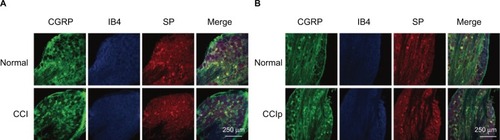 Figure 4 Expression of CGRP and SP in DRG neurons in CCI and CCIp rats.Notes: (A) Expression of CGRP and SP in DRG neurons in CCI rats, comparison of ipsilateral (CCI) to contralateral (normal). (B) Expression of CGRP and SP in DRG neurons in CCIp rats, comparison of ipsilateral (CCIp) to contralateral (normal). Scale bar: 250 μm.