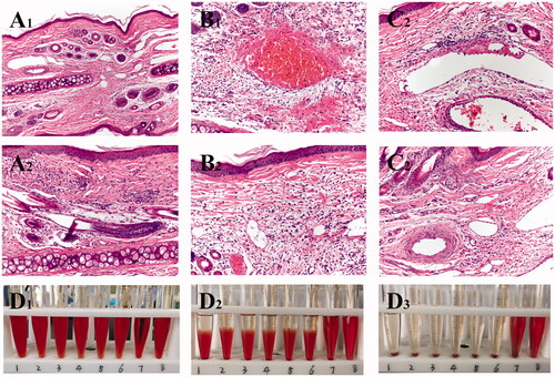 Figure 5. Images of rabbit pathological sections. Images of rabbit ear pathological sections. (A1,A2) NS group (200X); (B1,B2) SA-I group (200X); (C1,C2) SA-Lip-I group (200X). Hemolysis results. (D1–D3) Hemolysis results for SA-Lip-I at 0 h, 2 h and 4 h.