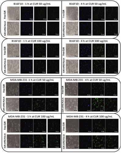 Figure 5. Fluorescence microscopy images of cancer cells (B16F10, and MDA-MB-231) to assess cellular uptake of CUR-loaded polymeric micelles. A. B16F10 cells treated with free CUR and CUR-mPEG–PLA-Ch at CUR concentration of 50 and 100 μg/mL; B. fluorescence micrograph of MDA-MB-231 cells following the same treatment as B16F10 cells. Blue and green signals present cell stained by DAPI and CUR fluorescence in cells, respectively (Scale bar = 20 μm).