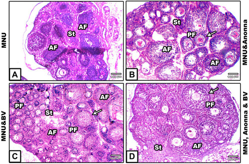 Figure 3 Microscopy of histological sections of ovaries of 21-day offspring among the groups. (A) MNU; (B) MNU and A. muricata; (C) MNU and BV; (D) MNU, A. muricata, and BV. The ovarian section in A) displays ovary shrinkage, with increased number of atretic primary follicles, and disintegrated germinal epithelium; (B–D) Remarkable restoration in damaged histological structures induced by MNU despite very few atretic follicles still apparent. Arrows, thecae externa.