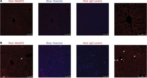 Figure 12 The MetAP2 immunofluorescence in livers obtained from lean mice (A) and DIO mice (B). The arrows indicate the non-parenchymal cells that infiltrated the DIO liver.