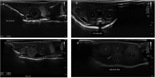 Figure 1. Ultrasonographic images of the coelomic cavity of a female West Coast green gecko (Naultinus tuberculatus) showing a) sagittal view of a single follicle (F) in the coelom on admission; b) transverse view of two follicles (F) in the coelom on admission; c) sagittal view of two follicles (F) in the coelom after 6 months of hospitalisation; d) oblique view of four follicles (F) in the coelom after 6 months of hospitalisation, suggestive of pre-ovulatory follicular stasis.