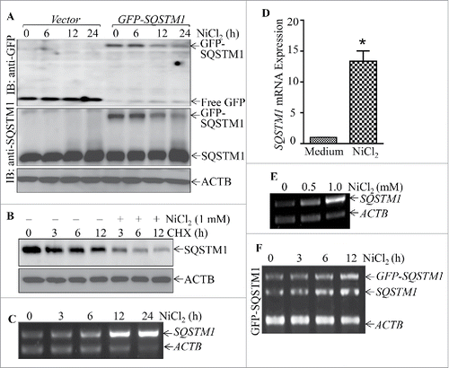 Figure 7. Nickel induced SQSTM1 transcription in Beas-2B cells. (A) 2×105 stable Beas-2B(GFP) and Beas-2B(GFP-SQSTM1) transfectants, as indicated, were seeded into each well of 6-well plates. The cells were exposed to 1.0 mM NiCl2 for the indicated time points. The cells were extracted with SDS-sample buffer and western blot was carried out. ACTB was used as protein loading control. (B) Beas-2B cells were treated with CHX (50 μg/ml) together with or without NiCl2 for the indicated times. The cell extracts were subjected to analysis of SQSTM1 protein degradation rate by western Blotting. (C, E and F) Beas-2B cells were exposed to 1.0 mM NiCl2 for different time points, as indicated (C), or treated with the indicated doses of NiCl2 for 12 h (E). The stable Beas-2B(GFP-SQSTM1) cells were exposed to 1.0 mM of NiCl2 for the indicated time periods (F). The cells collected from (C-F) were extracted with Trizol reagent for total RNA isolation and RT-PCR was performed to determine SQSTM1 or GFP-SQSTM1 expression with their specific primers. ACTB was used as an internal control. (D) Real-time PCR was carried out to determine the SQSTM1 mRNA expression using cDNA samples collected from Beas-2B cells exposed to 1.0 mM NiCl2 for 24 h obtained in (C). The symbol (*) indicates a significant increase as compared with the medium control (p < 0.05).