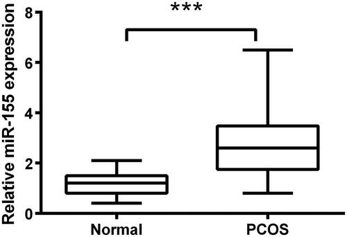 Figure 1. Overexpression of miR-155 occurred in PCOS tissues. qRT-PCR assay was employed to test expression of miR-155 between PCOS tissues and normal tissues. ***p<.001 in comparison with the normal group. The data were shown as mean ± SD.