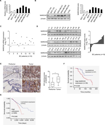 Figure 1 MARCH5 is upregulated in BC cells and contributes to worse prognosis.Notes: (A and B) Quantitative real-time PCR and Western blot assays for expressions of MARCH5 in five BC cell lines (MDA-MB-231, MDA-MB-468, MDA-MB-435, MCF-7, and T47D) and two nonmalignant human breast cell lines (MCF 10A and MCF 12A). (C and D) Quantitative real-time PCR and Western blot assays for expressions of MARCH5 in 18 paired BC tumor tissues and peritumor tissues (T, tumor; P, peritumor). Scale bars, 50 µm. The relative MARCH5 expression ratio of tumor to peritumor was log2-transformed. (E) Representative immunohistochemical (IHC) staining images (left panel, scale bar, 50 µm) and staining intensities (right panel) of MARCH5 in tumor and peritumor tissues from 65 BC patients. (F) Kaplan–Meier curve for survival analysis of 65 BC patients according to their MARCH5 expression levels. (G) Prognostic significance analysis for MARCH5 in BC using the online web portal UALCAN (http://ualcan.path.uab.edu). *P<0.05.Abbreviation: BC, breast cancer.