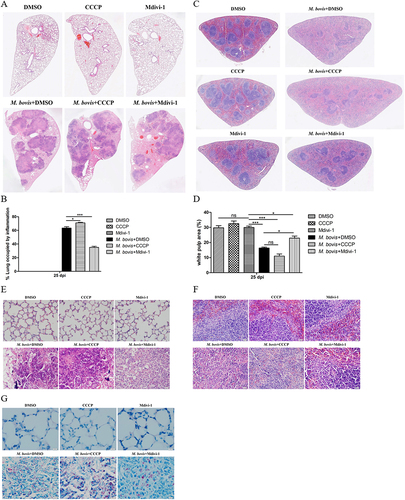 Figure 7. The effect of mitophagy on the histopathological lesions of lung and spleen in M. bovis-infected mice. (A) The representative images of left lung lobe showed histopathological changes of uninfected and M. bovis-infected mice. (B) The percentage of lung’s area occupied by inflammatory lesions were quantified by Image J software. (C) The representative histopathological changes in the spleen tissues of uninfected and M. bovis-infected mice. (D) The percentage area of white pulp of spleen was measured by Image J software. (E and F) Higher magnification of H&E staining sections of lung and spleen showed M. bovis induced lesions. Scale bar: 20 µm. (G) M. bovis (red color) in the lung sections were indicated by Ziehl-Neelsen staining. Scale bar: 10 µm. Statistical analysis was done by using Unpaired t-test (two-tailed). *p < 0.05, ***p < 0.001, ns, represent not significant.