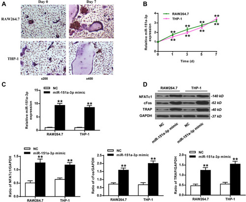 Figure 2 Overexpression of microRNA-151a-3p promoted RANKL-induced differentiation of THP-1 and RAW264.7 cells into osteoclasts. (A and B) RAW264.7 and THP-1 cells were treated with RANKL and M-CSF. (A) The representative images of TRAP-stained cells. Magnification, x200 (Day 0) and x400 (Day 7). (B) The expression levels of microRNA-151a-3p in RANKL/M-CSF-induced cells. (C and D) RANKL/M-CSF-induced RAW264.7 and THP-1 cells were treated with microRNA-151a-3p mimic. (C) Expression levels microRNA-151a-3p in RAW264.7 and THP-1 cells. (D) The expression levels of TRAP, NFATc1 and c-Fos. ** P < 0.01.