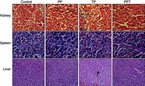 Figure 7 HE staining of liver, spleen, and kidney.Notes: Three-month-old C57/B6 mice were treated with PBS, PP, TP, or PPT. The liver, spleen, and kidney tissues of every treatment group were harvested for pathologic examination (magnification ×200). The circled areas show the renal glomerulus and the arrow is showing the hepatic nuclei.Abbreviations: HE, hematoxylin and eosin; PBS, phosphate-buffered saline; PP, l-PAAE-γ-PGA complex; l-PAE, l-phenylalanine ethylester; γ-PGA, poly-γ-glutamic acid; TP, triptolide; PPT, γ-PGA-l-PAE-TP.