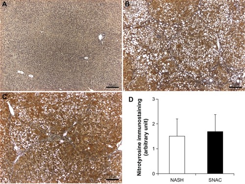 Figure 4 Representative nitrotyrosine immunostaining of liver sections.