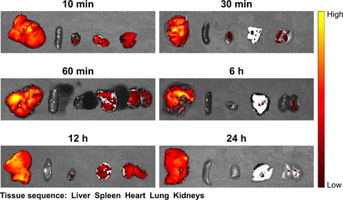 Figure S3 In vitro fluorescence imaging of tissues in healthy mice at different time points after DiI-labeled NBs-siRNA injection. The tissue sequence is liver, spleen, heart, lung, and kidneys. The liver initially showed a strong signal, whereas the spleen showed no signal.