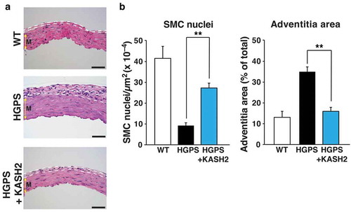 Figure 7. Expression of KASH2 in smooth muscle cells (SMCs) ameliorates aortic disease in a mouse model of HGPS. The HGPS mice (LmnaG609G/G609G mice) were homozygous for the most common point mutation found in children with HGPS. KASH2 expression was from a Cre-activatable transgene (KASH2-EGFP); KASH2 expression was activated by an Sm22-Cre transgene. (a) Representative images of H&E-stained cross sections of the outer curvature of the ascending aorta in wild-type (WT) mice (Lmna+/+KASH2-EGFP+Sm22-Cre+), HGPS mice (LmnaG609G/G609GKASH2-EGFP+), and HGPS mice that expressed KASH2 in aortic SMCs (LmnaG609G/G609GKASH2-EGFP+Sm22-Cre+). Dotted white lines outline the adventitial layer of the aorta. Colored yellow arrow indicates the medial layer of the aorta (m). Scale bars, 50 μm. (b) Bar graphs depicting medial SMCs (nuclei per μm2) and adventitial area as a percentage of total area of the cross section. n = 6/group; **P < 0.001 as defined by a Student’s t test. Reproduced with permission from Kim et al. [Citation47].