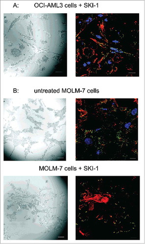 Figure 6. Localization of autophosphorylated Lyn kinase in cells treated with SKI-1. The cells were incubated for 1 h on fibronectin, then treated with 20 µM SKI-1 for 30 to 60 min. The sample was fixed and the active Lyn was detected using anti-phospho-SFK (Tyr416) and Alexa-488-conjugated secondary antibody. Red: actin polymers visualized by phalloidin, blue: nuclei (DAPI). IRM and IF from the same visual field are shown in each pair of images. A: OCI-AML3 cells, B: MOLM-7 cells. Scale bars: 10 µm.
