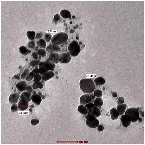 Figure 6. Transmission electron microscopy (TEM) of silver nanoparticles biofabricated using the Hugonia mystax aqueous extract.