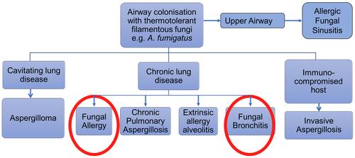 Figure 1 Various presentations of fungal involvement in lung disease.