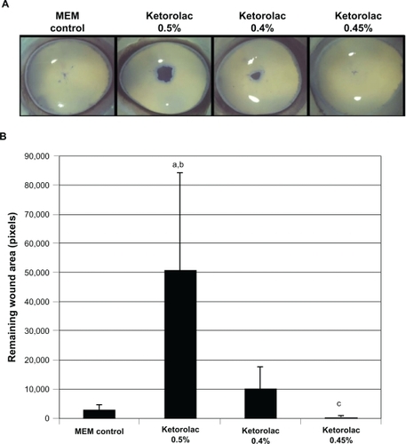 Figure 2 Remaining epithelial wound area in corneas treated with various ophthalmic solutions of ketorolac. Representative images of corneas treated with ketorolac 0.5%, 0.4%, and 0.45% A) and corresponding intensity of the wound area staining B) are shown.