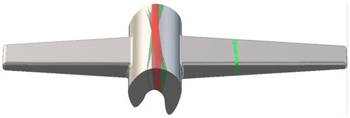 Figure 8 Stress model; The green line is the fracture position of the implant in group B, and the red line is in group A. The darker the color, the more frequent fractures.