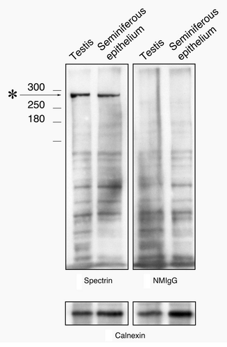 Figure 2. Western blot of testis and seminiferous epithelium lysates labeled with the spectrin antibody and with normal mouse IgG. A single band at the appropriate molecular weight for spectrin (asterisk) is present in material labeled with the spectrin antibody that is not present in material labeled with normal mouse IgG. To control for protein loading, bots were stripped and re-probed for calnexin.