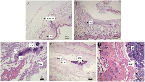 Figure 12 Histological features of mice after subcutaneous injection of FNMs at 2 h (A), 2 d (B), 7 d (C), 14 d (D), and 28 d (E).Abbreviations: FNMs, magnetic polymer microspheres; ic, inflammatory cells; cf, collagen fibers; bv, blood vessels; ms, microspheres.