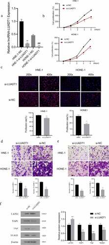 Figure 2. The effect of LUADT1 expression on the nasopharyngeal carcinoma process