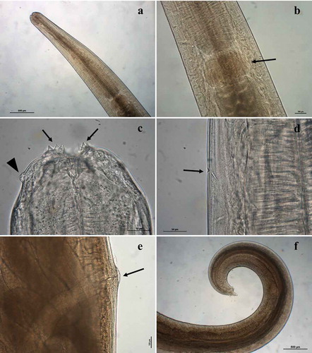 Figure 3. Acanthocheilus rotundatus adults: (a) male specimen, anterior end; (b) male specimen, detail of ventriculus (arrow); (c) male specimen, anterior end with detail of bifid teeth (arrows) and double papilla (arrowhead); (d) male specimen, detail of excretory pore (arrow); (e) female specimen, detail of vulva (arrow); male specimen, caudal end