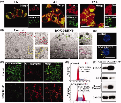 Figure 4. (A) CLSM images of the distribution of DOX in the organelles of 4T1 cells after incubation with DOX@BHNP for 2, 4, and 12 h (scale bar: 30 µm). (B) Mitochondrial morphology of 4T1 cell after incubation with DOX@BHNP for 24 h (scale bar: 2 µm). (C) Mitochondrial membrane potential of 4T1 cells after incubation with DOX@BHNP for 24 h (scale bar: 30 µm). (D) Flow cytometry analysis of cell cycle in 4T1 cells after incubation with DOX@BHNP for 24 h, and the specific cell cycle phases are indicated: G0/G1 = gap 1; S = synthesis; G2/M = gap 2 and mitosis (DOX concentrations: 6 µg mL−1). (E) Nuclear DNA leakage of 4T1 cells after incubation with DOX@BHNP for 24 h (scale bar: 10 µm). (F) Western blot assay of p-H2AX, Bcl-2, and cleaved caspase-3 expression in 4T1 cells after incubation with DOX@BHNP for 24 h. The cells without treatment were used as a control.