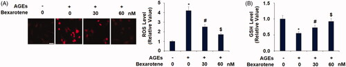 Figure 1. Bexarotene inhibits AGE-induced oxidative stress. (A). Levels of ROS in SW1353 cells determined by dihydroethidium (DHE) staining. Scale bar, 100 μm; (B). Levels of reduced glutathione (GSH) (*, p < .01 vs. vehicle group; #, p < .01 vs. AGE group; $, p < .01 vs. AGE + 30 nM bexarotene, n = 5–6).