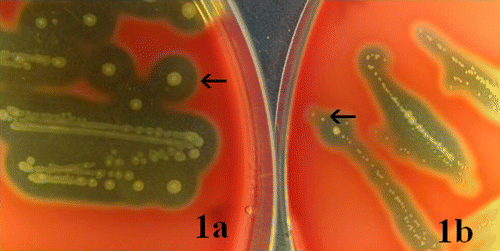 Figure 1.  Colonies of the WT and SCV strains of S. zooepidemicus. Arrows indicate typical colonies of the respective strains. 1a: WT: after 48 h of incubation at 37°C, the easily visible typical colonies of the WT appeared with whitish to yellowish colour, circular and convex shape, single or short-chain form, and each of 1 to 2 mm in diameter, an entire margin, mucoid capsule and clear β-haemolytic zone (WT colonies were also observed at 24 h of incubation). 1b SCV: colonies of the SCV were observed after 48 h of incubation at 37°C as grey transparent to white dry pin-points, sometimes too tiny to see with the naked eye, circular and convex shape, mostly in chain form, and each up to 0.5 mm in diameter, an entire margin, faint β-haemolytic zone and without capsule (SCV colonies were not shown following 24 h of incubation; however, in very few cases they were observed as around 0.1 mm in diameter).