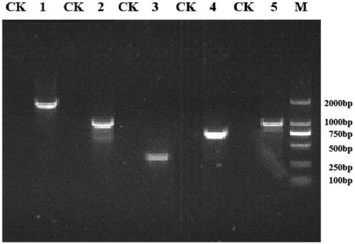 Figure 7. Agarose gel electrophoresis of the RT-PCR assay for detection of estrogen degrading enzyme expression in the presence of E2.