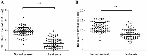 Figure 1. HBA1 and HBB in leukemia patients and normal control. The relative HBA1 and HBB expression was determined by RT-qPCR. (A) Levels of HBA1 in leukemia patients are significantly lower than that in normal control. (B) Levels of HBB in leukemia patients are significantly lower than that in normal control, **P < .01.