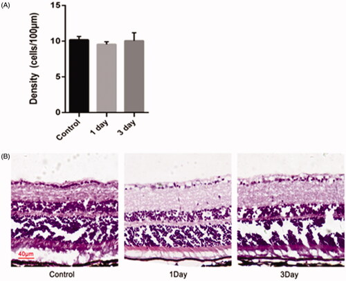 Figure 9. Morphological changes and cell density of RGCs in the retina of mice after an intravitreal injection of miRNA/NP-BRZ. There was no significant difference in the retina on day 1 and day 3 after miRNA/NP-BRZ injection compared to the normal retina. Abnormal changes in cell morphology was not observed in the 3 groups. Scale bar: 40 μm; Statistical significance was set at p < .05; miRNA/NP-BRZ, drug-loaded nanoparticles.