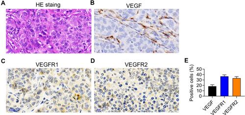 Figure 2 Patient-derived xenograft (PDX) model characterization. (A) Hematoxylin and Eosin staining of PDX tissue. (B–D) VEGF (B), VEGFR1 (C), and VEGFR2 (D) expression in the PDX model detected by immunohistochemical staining. (E) The statistical analysis of (B–D). n=5.