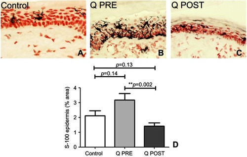 Figure 8 Immunohistochemistry in skin biopsies for Langerhans cells (LCs), before and after capsaicin 8% patch treatment. LCs immunostaining in the epidermis of calf skin from (A) control subjects, and CIPN patients before (B, Q PRE) and after capsaicin 8% patch treatment (C, Q POST), magnification x40. (D) Bar chart showing LCs image analysis (% area).Note: **Very significant.