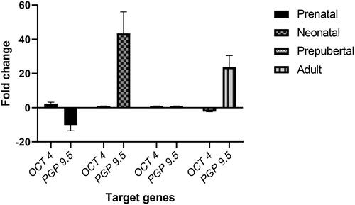 Figure 5. Relative gene expression of OCT 4 and PGP 9.5 in testes of buffalo.