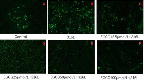 Figure 1 Fluorescent images of HUVECs grown on 316L surface. Cultured for 3 days (*40). (A) Control (B) 316L (C) 316L +12.5 μmol/L, (D), 316L+25 μmol/L (E) 316L+50 μmol/L, and (F) 316L+100 μmol/L.