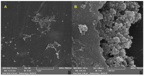 Figure 3 FESEM images of the synthesized CuO-NPs with different magnifications: (A) 2µm and (B) 500 nm.