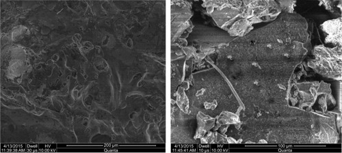 Figure 4 Scanning electron micrographs of lyophilized hydrogel microparticles.