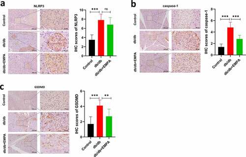 Figure 5. The protein expressions of NLRP3, caspase-1 and GSDMD were assumed by immunohistochemistry. (a) Immunohistochemical images and scores of NLRP3 of pancreas in mice treated with different methods. (b) Immunohistochemical images and scores of caspase-1 of pancreas in mice treated with different methods. (c) Immunohistochemical images and scores of GSDMD of pancreas in mice treated with different methods. ns P > 0.05; * P < 0.05; ** P < 0.01; *** P < 0.001. NLRP3: nucleotide-binding oligomerization domain-like receptor protein 3; GSDMD: Gasdermin D.