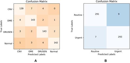 Figure 7 Confusion matrixes of the model and referral ability. (A) Shows the confusion matrix of automatically diagnosing multiple diseases with the model on the testing set. (B) Shows the confusion matrix of the model’s ability to refer to the testing set, and this confusion matrix could give the model specificity and sensitivity to the referral problem. CNV means choroidal neovascularization, DME means diabetic macular edema).