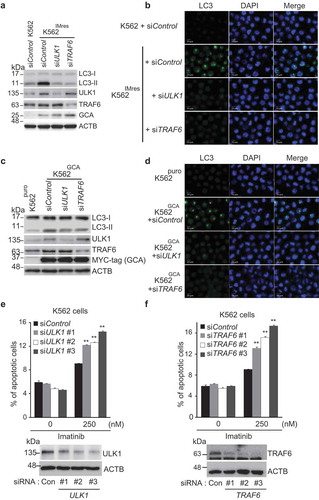 Figure 7. GCA induced autophagy through ULK1-TRAF6 regulatory axis to control imatinib resistance. (a) K562 and K562IMres cells were transfected with control, ULK1 or TRAF6 siRNAs. Cell lysates were subjected to immunoblotting analysis of LC3-I, LC3-II, ULK1, TRAF6, GCA and ACTB. (b) The same samples were immunostained with LC3 to visualize autophagosomes (green) and DAPI for nuclei (blue). Scale bar: 10 μm. (c) K562puro and K562GCA cells were transfected with control, ULK1 or TRAF6 siRNAs. Cell lysates were subjected to immunoblotting for LC3-I, LC3-II, ULK1, TRAF6, MYC-tag GCA and ACTB. (d) The same samples were immunostained with LC3 to visualize autophagosomes (green) and DAPI for nuclei (blue). Scale bar: 10 μm. (e-f) K562 cells were transfected with control and 3 independent ULK1 siRNAs (e) or 3 independent TRAF6 siRNAs (f) and subjected to apoptosis analysis by FACS. The ratio (%) of the apoptotic cell was graphed with S.D. as error bar (top panel) and knockdown efficiency checked using western blot indicated antibodies (bottom panel). Student’s t-test, **p < 0.01.