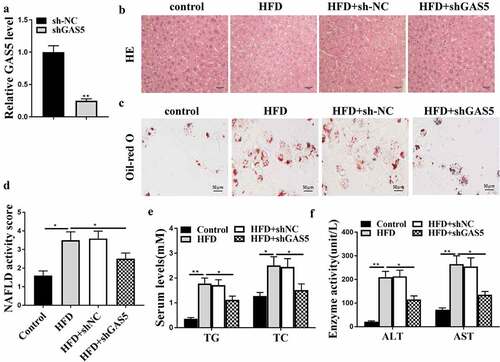 Figure 2. GAS5 promotes NAFLD progression in vivo. (a-f) NAFLD mouse model was established. (a) GAS5 expression in mouse liver tissues was determined by qPCR assays. (b) Hepatic steatosis was measured by H&E staining. (c) Oil Red O staining of mouse liver tissues. (d) NAFLD activity score was quantified. (e) Serum TC and TG levels were analyzed by ELISA. (f) Serum AST and ALT levels were tested by ELISA. Data are presented as mean ± SD. * P < 0.05, ** P < 0.01.