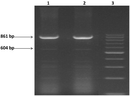 Figure 1. Agarose gel picture showing deletional high persistence of fetal hemoglobin (HPFH-3). Amplification of 861 bp PCR product is for normal whereas 604 bp is deletional HPFH. Lane 1,2 is positive for Indian deletion. Lane 3 is 100 bp marker.