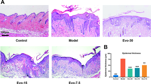 Figure 3 Effect of evodiamine on IMQ-induced lesion skin in mice. (A) Representative H&E-stained skin Images. (B) Measurements of epidermal thickness on day 7 (Scale bar = 100 μm). Data were expressed as mean ± SEM (n=3). ###p<0.001 indicates control group vs. model group. **p<0.01, and ***p<0.001 indicates evodiamine groups vs. model group.