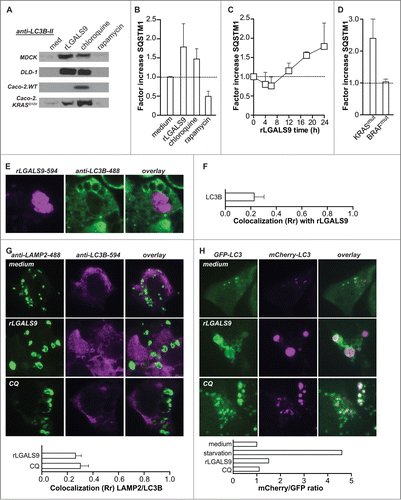Figure 6. Lysosomal accumulation of rLGALS9 results in halted autophagy. (A) LC3B-II levels after 24 h treatment of the indicated cell lines with rLGALS9 (300 nM), autophagy inhibitor chloroquine (100 μM) or autophagy inducer rapamycin (100 nM). (B) Analysis of SQSTM1 levels using ELISA after treatment of DLD-1 as in (A) (factor = rLGALS9/medium). (C) Time-course analysis of SQSTM1 levels in DLD-1 cells treated with rLGALS9 (24 h, 300 nM). (D) SQSTM1 formation induced by rLGALS9 treatment (24 h, 300 nM) in a panel of KRASmut cell lines (n = 5) and BRAFmut (n = 5). (E) Confocal microscopy pictures of DLD-1 cells treated for 24 h with DyLight-594-labeled rLGALS9 and costained with anti-LC3B-488. (F) LC3B/rLGALS9 colocalization was analyzed by Pearson's correlation. (G) Confocal microscopy pictures of DLD-1 cells treated with rLGALS9 (24 h, 300 nM) or chloroquine (24 h, 100 μM) and subsequently stained with anti-LAMP2 and anti-LC3B. LAMP2/LC3B colocalization was analyzed by Pearson's correlation. (H) Confocal microscopy pictures of DLD-1 cells transfected with a mCherry-GFP-LC3 construct treated with rLGALS9 (24 h, 300 nM) or chloroquine (24 h, 100 µM). mCherry/GFP ratio was analyzed using ImageJ software.